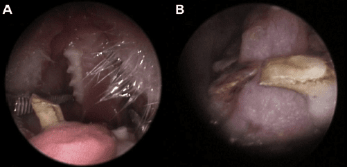 Pathologies dentaires et malocclusions chez l'octodon 13 Deux vues rapprochées de la cavité buccale d’un rongeur, montrant la langue et les dents.